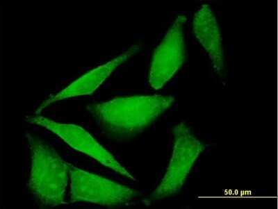 Immunocytochemistry/Immunofluorescence: FBXO40 Antibody [H00051725-B01P] - Analysis of purified antibody to FBXO40 on HeLa cell. (antibody concentration 10 ug/ml)