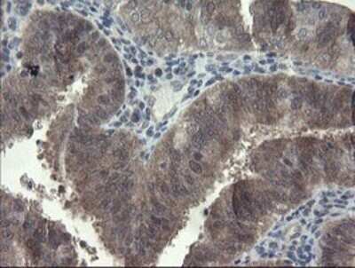 Immunohistochemistry: FBXO42 Antibody (OTI1H4) - Azide and BSA Free [NBP2-71960] - Analysis of Human pancreas tissue.