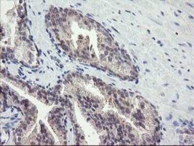 Immunohistochemistry: FBXO42 Antibody (OTI1H4) - Azide and BSA Free [NBP2-71960] - Analysis of Human prostate tissue.