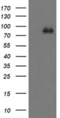 Western Blot: FBXO42 Antibody (OTI1H4) - Azide and BSA Free [NBP2-71960] - Analysis of HEK293T cells were transfected with the pCMV6-ENTRY control (Left lane) or pCMV6-ENTRY FBXO42.