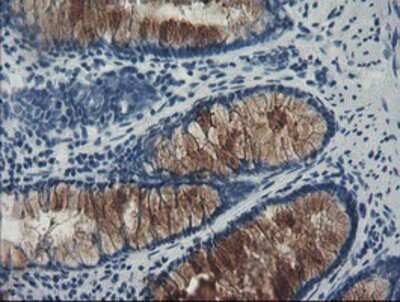 Immunohistochemistry: FBXO42 Antibody (OTI2G7) - Azide and BSA Free [NBP2-71958] - Staining of paraffin-embedded Human colon tissue using anti-FBXO42 mouse monoclonal antibody.