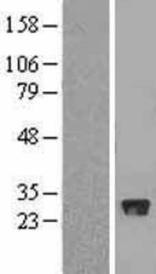 Western Blot: FBXO44 Overexpression Lysate (Adult Normal) [NBP2-08742] Left-Empty vector transfected control cell lysate (HEK293 cell lysate); Right -Over-expression Lysate for FBXO44.