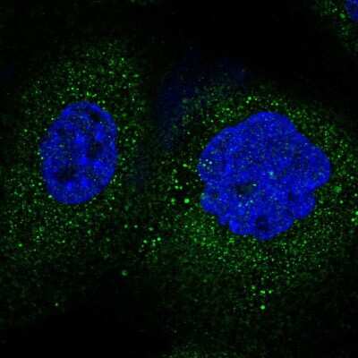 Immunocytochemistry/Immunofluorescence: FBXO45 Antibody [NBP1-91891] - Staining of human cell line A-431 shows positivity in cytoplasm. Antibody staining is shown in green.