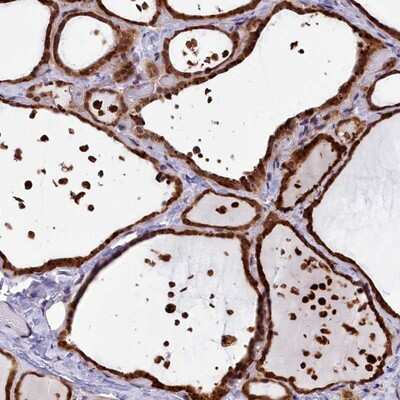 Immunohistochemistry-Paraffin: FBXO45 Antibody [NBP1-91891] - Staining of human thyroid gland shows strong cytoplasmic and nuclear positivity in glandular cells.