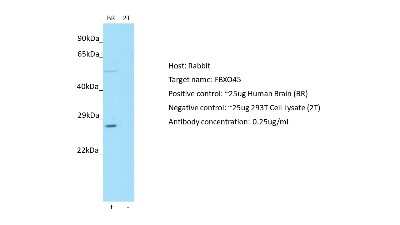 Western Blot: FBXO45 Antibody [NBP2-82765] - Host: Rabbit. Target: FBXO45. Positive control (+): Human brain (BR). Negative control (-): 293T (2T). Antibody concentration: 0.25ug/ml
