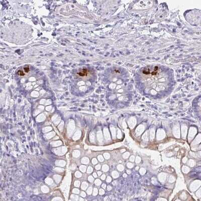 Immunohistochemistry: FBXO47 Antibody [NBP2-31679] - Staining of human small intestine shows strong positivity in paneth cells.