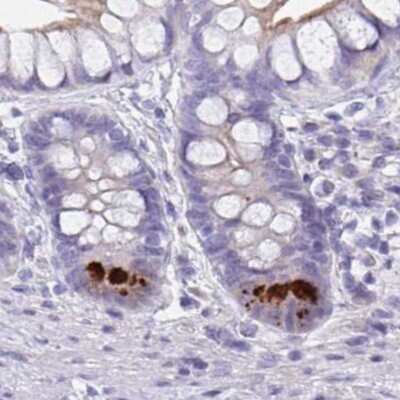 Immunohistochemistry: FBXO47 Antibody [NBP2-31679] - Staining of small intestine.
