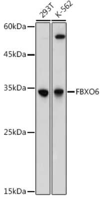 Western Blot: FBXO6 Antibody [NBP3-15332] - Western blot analysis of extracts of various cell lines, using FBXO6 antibody (NBP3-15332) at 1:1000 dilution. Secondary antibody: HRP Goat Anti-Rabbit IgG (H+L) at 1:10000 dilution. Lysates/proteins: 25ug per lane. Blocking buffer: 3% nonfat dry milk in TBST. Detection: ECL Basic Kit. Exposure time: 15s.