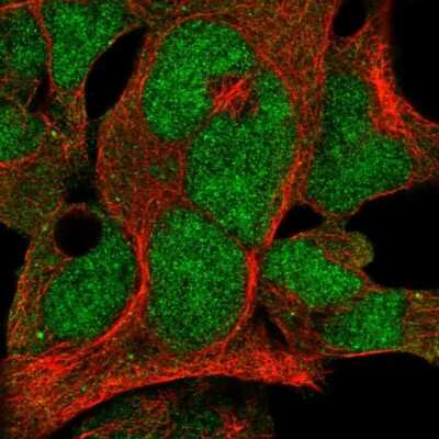 Immunocytochemistry/Immunofluorescence: FBXO7 Antibody [NBP2-58563] - Staining of human cell line HEK 293 shows localization to nucleus & cytosol.