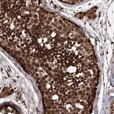 Immunohistochemistry-Paraffin: FBXO7 Antibody [NBP1-84713] - Staining of human testis shows strong cytoplasmic and nuclear positivity in cells in seminiferus ducts.