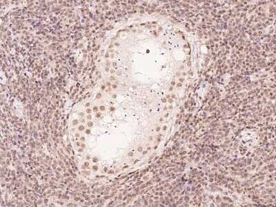 Immunohistochemistry-Paraffin: FBXO7 Antibody [NBP2-97739] - Immunochemical staining of human FBXO7 in human testis with rabbit polyclonal antibody at 1:300 dilution, formalin-fixed paraffin embedded sections.