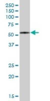 Western Blot: FBXO7 Antibody [H00025793-B01P] - Analysis of FBXO7 expression in human placenta.