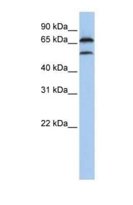 Western Blot: FBXO7 Antibody [NBP1-55051] - Titration: 0.2-1 ug/ml, Positive Control: MCF7 cell lysate.