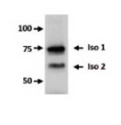 Western Blot FBXO7 Antibody