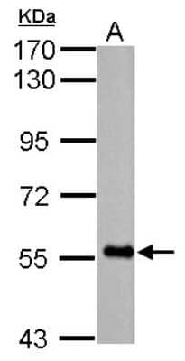 Western Blot: FBXO7 Antibody [NBP2-16452] - Sample (30 ug of whole cell lysate) A: HL-60 7. 5% SDS PAGE gel, diluted at 1:1000.