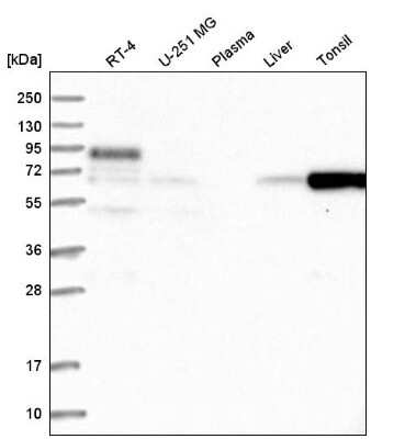 Western Blot FBXO7 Antibody