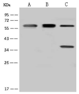 Western Blot: FBXO7 Antibody [NBP2-97739] - Anti-FBXO7 rabbit polyclonal antibody at 1:500 dilution. Lane A: MCF7 Whole Cell Lysate Lane B: HL-60 Whole Cell Lysate Lane C: U-251 MG Whole Cell Lysate Lysates/proteins at 30 ug per lane. Secondary Goat Anti-Rabbit IgG (H+L)/HRP at 1/10000 dilution. Developed using the ECL technique. Performed under reducing conditions. Predicted band size: 59 kDa. Observed band size: 59 kDa