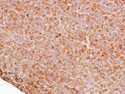 Immunohistochemistry-Paraffin: FBXW11 Antibody [NBP1-33738] - Paraffin-embedded H1299 xenograft, using antibody at 1:100 dilution.