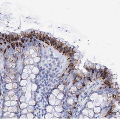 Immunohistochemistry: FBXW12 Antibody [NBP2-30761] - Staining of human colon shows strong cytoplasmic positivity in goblet cells.