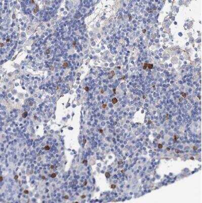 Immunohistochemistry: FBXW12 Antibody [NBP2-30769] - Staining of human lymph node shows strong cytoplasmic positivity in subset of non germinal center cells.