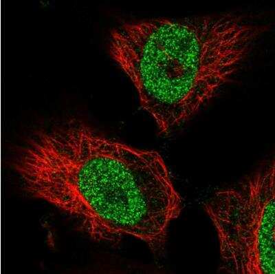 Immunocytochemistry/Immunofluorescence: FBXW2 Antibody [NBP2-39089] - Staining of human cell line U-251 MG shows localization to nucleoplasm. Antibody staining is shown in green.