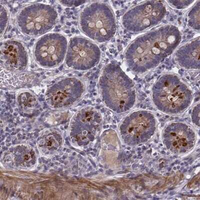 Immunohistochemistry-Paraffin: FBXW2 Antibody [NBP2-39089] - Staining of human duodenum shows strong granular cytoplasmic positivity in a subset of glandular cells.