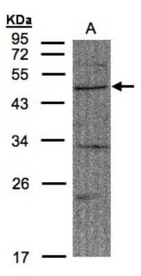 Western Blot: FBXW2 Antibody [NBP1-31019] - Sample(30 ug of whole cell lysate)A:A431(GTX27909)10% SDS PAGE, antibody diluted at 1:1500.