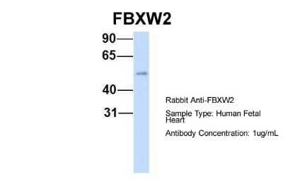 Western Blot: FBXW2 Antibody [NBP1-55043] - Human Fetal Heart, Antibody Dilution: 1.0 ug/ml.