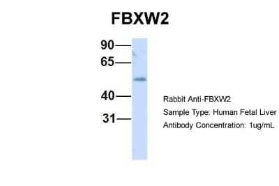 Western Blot: FBXW2 Antibody [NBP1-55043] - Human Fetal Liver, Antibody Dilution: 1.0 ug/ml.