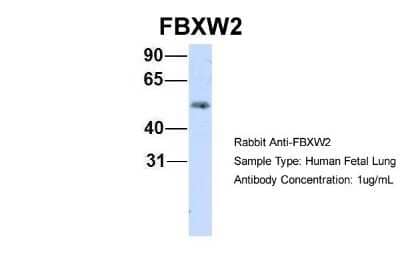 Western Blot: FBXW2 Antibody [NBP1-55043] - Human Fetal Lung, Antibody Dilution: 1.0 ug/ml.