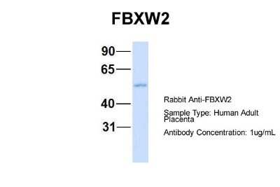 Western Blot: FBXW2 Antibody [NBP1-55043] - Sample Type: Human Adult Placenta Antibody Dilution: 1.0 ug/ml