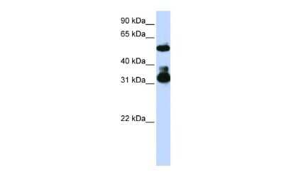 Western Blot: FBXW2 Antibody [NBP1-55043] - Reccomended Titration: 0.2 - 1 ug/ml ELISA Titer: 1:1562500 Positive Control: Jurkat cell lysate FBXW2 is supported by BioGPS gene expression data to be expressed in Jurkat