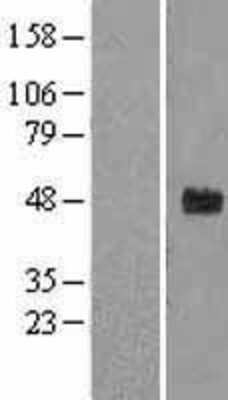 Western Blot: FBXW2 Overexpression Lysate (Adult Normal) [NBL1-10646] Left-Empty vector transfected control cell lysate (HEK293 cell lysate); Right -Over-expression Lysate for FBXW2.