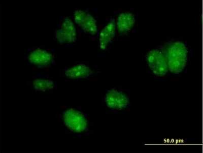 Immunocytochemistry/Immunofluorescence: FBXW7/Cdc4 Antibody [H00055294-B01P] - Analysis of purified antibody to FBXW7 on HeLa cell. (antibody concentration 10 ug/ml)