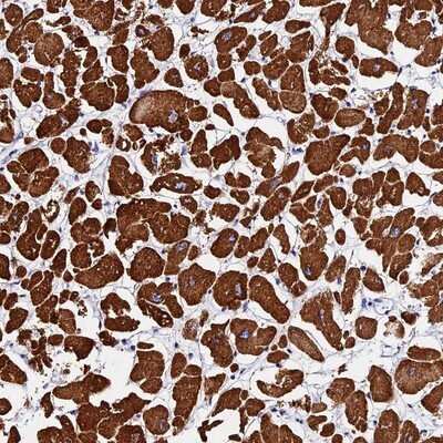 Immunohistochemistry-Paraffin: FBXW9 Antibody [NBP1-84714] - Staining of human heart muscle shows strong cytoplasmic positivity in myocytes.