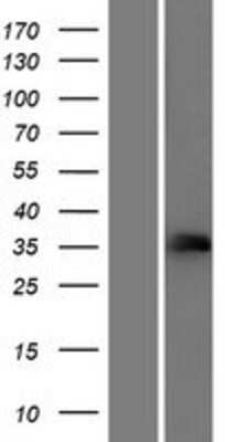 Western Blot: FCGR2C Overexpression Lysate (Adult Normal) [NBP2-04598] Left-Empty vector transfected control cell lysate (HEK293 cell lysate); Right -Over-expression Lysate for FCGR2C.