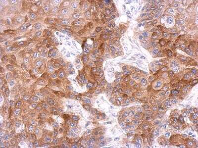 Immunohistochemistry-Paraffin: FCHO1 Antibody [NBP2-16459] - Immunohistochemical analysis of paraffin-embedded cal27 xenograft, using antibody at 1:500 dilution.