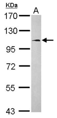 Western Blot: FCHO1 Antibody [NBP2-16459] - Sample (30 ug of whole cell lysate) A: Raji 7. 5% SDS PAGE gel, diluted at 1:1000.