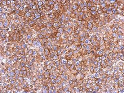 Immunohistochemistry-Paraffin: FCHO2 Antibody [NBP2-16460] - Immunohistochemical analysis of paraffin-embedded H1299 xenograft, using antibody at 1:500 dilution.