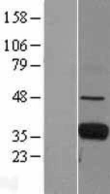 Western Blot: FCN1 Overexpression Lysate (Adult Normal) [NBL1-10662] Left-Empty vector transfected control cell lysate (HEK293 cell lysate); Right -Over-expression Lysate for FCN1.