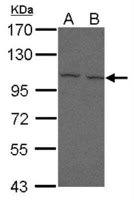 Western Blot: FCRL5/FcRH5/IRTA2 Antibody [NBP2-16994] -  Sample (30 ug of whole cell lysate) A: 293T B: A431 7. 5% SDS PAGE gel, diluted at 1:500.