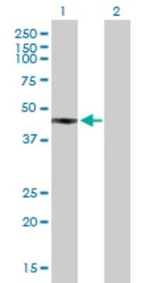 Western Blot: FCRLA/FCRLM1 Antibody [H00084824-B01P] - Analysis of FCRLA expression in transfected 293T cell line by FCRLA polyclonal antibody.  Lane 1: FCRLM1 transfected lysate(41.36 KDa). Lane 2: Non-transfected lysate.