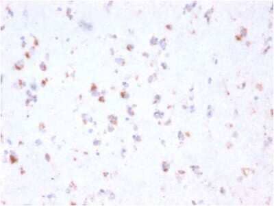 Immunohistochemistry-Paraffin: FCRN/FCGRT Antibody (FCGRT/2932) - Azide and BSA Free [NBP3-08224] - Formalin-fixed, paraffin-embedded human Cerebellum stained with FCRN/FCGRT Mouse Monoclonal Antibody (FCRN/FCGRT/2932).