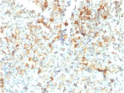 Immunohistochemistry-Paraffin: FCRN/FCGRT Antibody (FCGRT/2932) - Azide and BSA Free [NBP3-08224] - Formalin-fixed, paraffin-embedded human Testicular Cancer stained with FCRN/FCGRT Mouse Monoclonal Antibody (FCRN/FCGRT/2932).