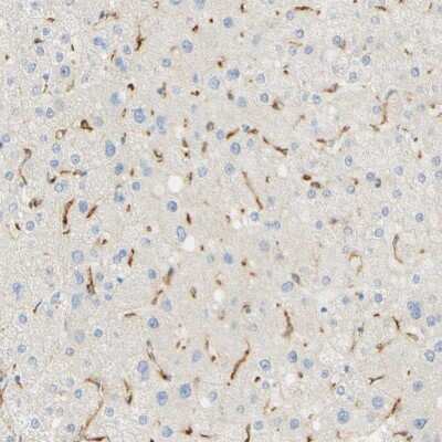 Immunohistochemistry-Paraffin: FCRN/FCGRT Antibody [NBP1-89128] - Immunohistochemical staining of human liver shows moderate to strong cytoplasmic positivity in Kupffer cells.