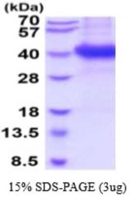 SDS-Page: Recombinant Mouse FCRN/FCGRT Protein [NBP2-53082] - 15% SDS-PAGE (3ug)