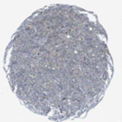 Immunohistochemistry: FDCSP Antibody [20620002] - Normal and malignant tissues were generally negative. A sub-population of cells in the salivary gland and surface epithelial cells of tonsil showed strong cytoplasmic positivity. Weak to moderate nuclear and/or cytoplasmic positivity was observed in many cases of ovarian and cervical cancers.  Image and statement courtesy of the Human Protein Atlas (HPA).