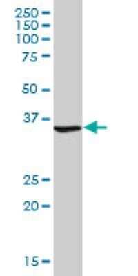 Western Blot: FDPS Antibody [H00002224-B01P] - FDPS MaxPab polyclonal antibody. Western Blot analysis of FDPS expression in human placenta.