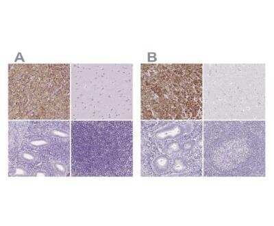 Immunohistochemistry-Paraffin: FDX1 Antibody [NBP1-89227] - Staining of human adrenal gland, cerebral cortex, endometerium and tonsil using Anti-FDX1 antibody NBP1-89227 (A) shows similar protein distribution across tissues to independent antibody (B).