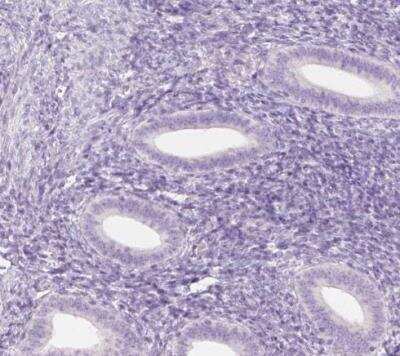 Immunohistochemistry-Paraffin: FDX1 Antibody [NBP1-89227] - Staining of human endometrium shows no positivity in glandular cells as expected.